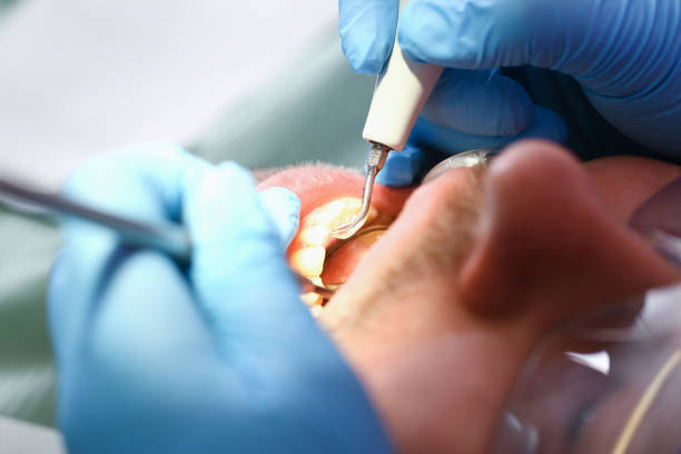 Best Walk-In Emergency Dental Services in Burns Harbor, IN