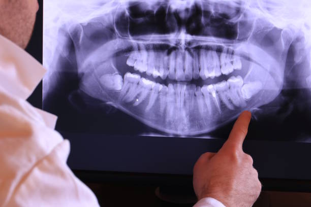 Best Emergency Treatment for Jaw Pain or Injury in Burns Harbor, IN